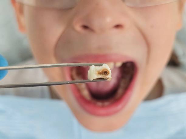 Best Cracked Tooth Emergency Dentist  in Elizabeth, PA